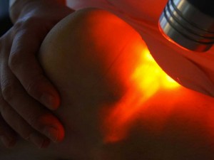 Laser Terapia_Centro Athena Napoli