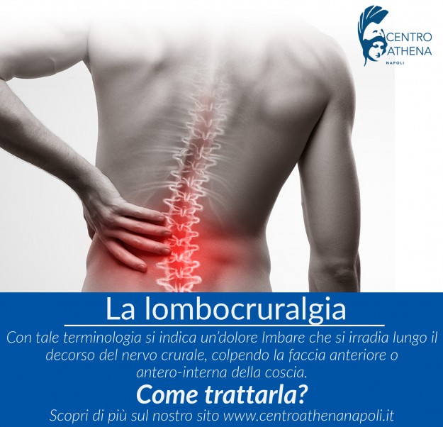 lombocruralgia