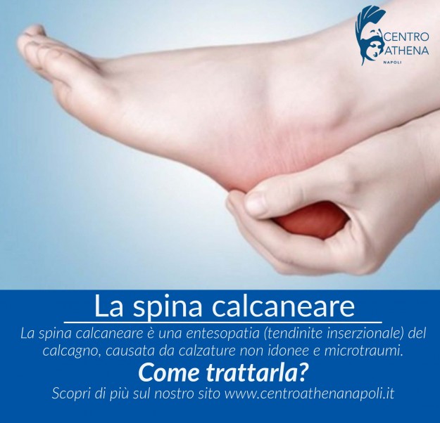 spinacalcaneare