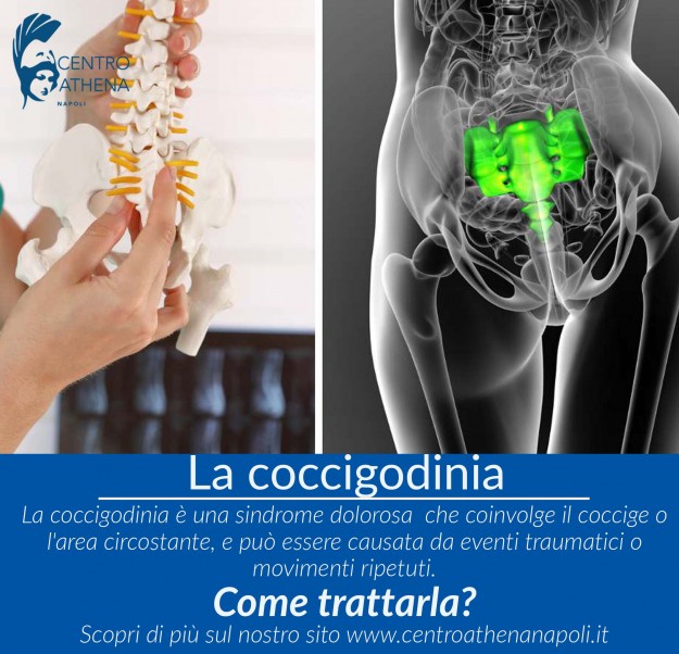 coccigodinia